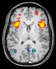 The insular cortex (yellow/red) is involved in "fairness" response.